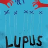 Lupus | 9789047710325