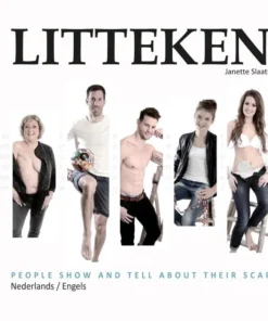 Litteken