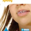 Spuug | 9789463419161 Spuug | 9789463419161