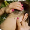 Teken, luizen en andere parasieten | 9789464390636